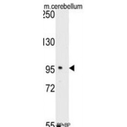 Semaphorin 6A (SEMA6A) Antibody