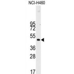 Desmin (DES) Antibody
