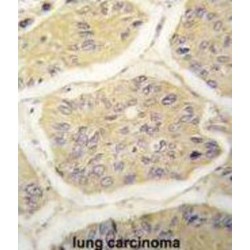 Beta-2-Microglobulin (B2M) Antibody