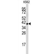 Fibrillarin (FBL) Antibody