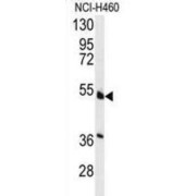abx031702