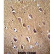 Gamma-Enolase (ENO2) Antibody