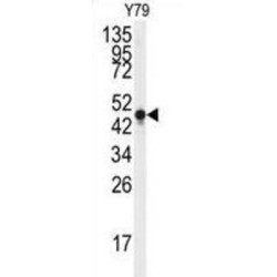 Gamma-Enolase (ENO2) Antibody