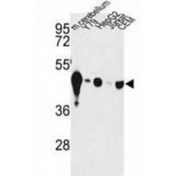 Gamma-Enolase (ENO2) Antibody