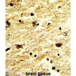 Exosome Component 8 (EXOSC8) Antibody