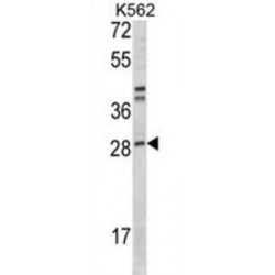 Nicotinamide Riboside Kinase 2 / ITGB1BP3 (NMRK2) Antibody