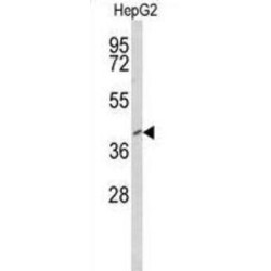 Forkhead Box Protein P3 (FOXP3) Antibody