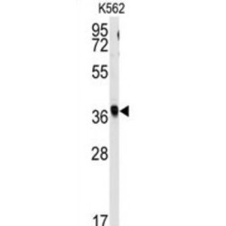 Replication Factor C Subunit 2 (RFC2) Antibody