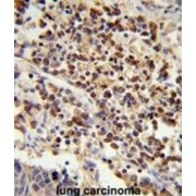 Splicing Factor U2AF 35 kDa Subunit (U2AF1) Antibody
