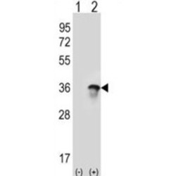 Splicing Factor U2AF 35 kDa Subunit (U2AF1) Antibody