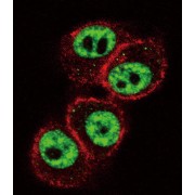 Runt Related Transcription Factor (RUNX1) Antibody