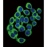 Ataxin 1 (ATXN1) Antibody