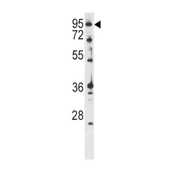 Ataxin 1 (ATXN1) Antibody
