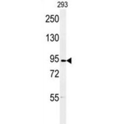 Disks Large-Associated Protein 5 / HURP (DLGAP5) Antibody