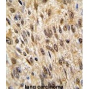 Protein Tyrosine Phosphatase, Non-Receptor Type 6 (PTPN6) Antibody