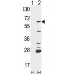 Protein Tyrosine Phosphatase, Non-Receptor Type 6 (PTPN6) Antibody