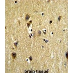 Stress-Induced-Phosphoprotein 1 (STIP1) Antibody