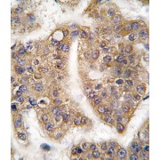 E3 Ubiquitin-Protein Ligase TRAIP (TRAIP) Antibody