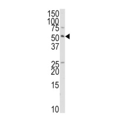 E3 Ubiquitin-Protein Ligase TRAIP (TRAIP) Antibody