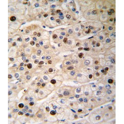 Proliferating Cell Nuclear Antigen (PCNA) Antibody
