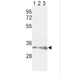 Proliferating Cell Nuclear Antigen (PCNA) Antibody