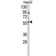 24-Dehydrocholesterol Reductase (DHCR24) Antibody