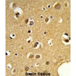 Small Nuclear Ribonucleoprotein Polypeptide C (SNRPC) Antibody