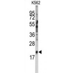 Small Nuclear Ribonucleoprotein Polypeptide C (SNRPC) Antibody