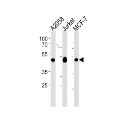ErbB3-Binding Protein 1 (EBP1) Antibody