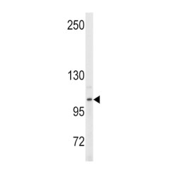 Ectonucleotide Pyrophosphatase/phosphodiesterase 2 (ENPP2) Antibody