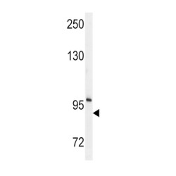 Ectonucleotide Pyrophosphatase/phosphodiesterase 2 (ENPP2) Antibody