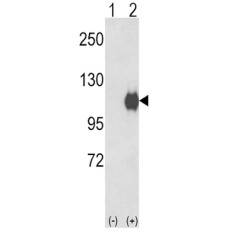 Ectonucleotide Pyrophosphatase/phosphodiesterase 2 (ENPP2) Antibody