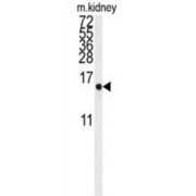 LSM1 Homolog, mRNA Degradation Associated (LSM1) Antibody