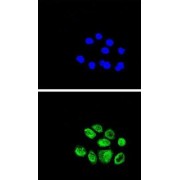 Exonuclease 1 (EXO1) Antibody