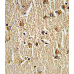 Heat Shock 70 kDa Protein 8 (HSPA8) Antibody