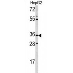 Cyclic ADP Ribose Hydrolase (CD38) Antibody