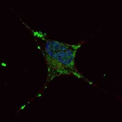 Elongator Acetyltransferase Complex Subunit 2 (ELP2) Antibody