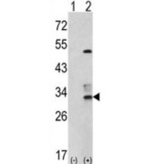 Capping Protein (Actin Filament) Muscle Z-Line, Beta (CAPZB) Antibody