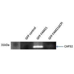 Capping Protein (Actin Filament) Muscle Z-Line, Beta (CAPZB) Antibody