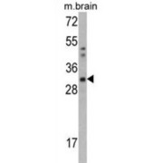Capping Protein (Actin Filament) Muscle Z-Line, Beta (CAPZB) Antibody