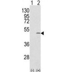 Capping Protein (Actin Filament) Muscle Z-Line, Beta (CAPZB) Antibody
