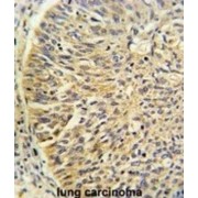 T-Complex Protein 1 Subunit Gamma (CCT3) Antibody
