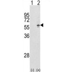 T-Complex Protein 1 Subunit Gamma (CCT3) Antibody