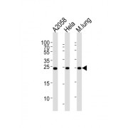 Rho GDP-Dissociation Inhibitor 1 (ARHGDIA) Antibody
