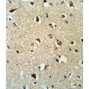 abx031778