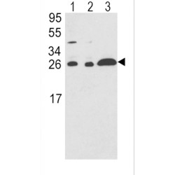 Rho GDP-Dissociation Inhibitor 1 (ARHGDIA) Antibody