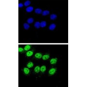 abx031785