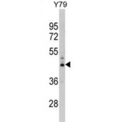 26S Proteasome Non-ATPase Regulatory Subunit 13 (PSMD13) Antibody