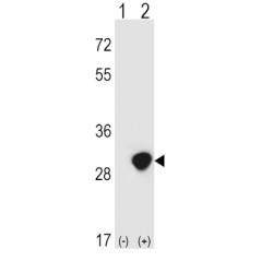 Triosephosphate Isomerase (TPI1) Antibody