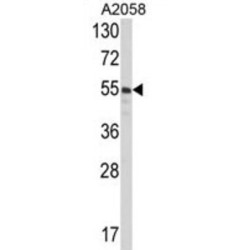 Protein Disulfide Isomerase A3 (PDIA3) Antibody